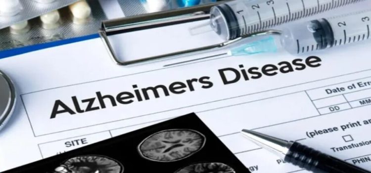 Lanzan al mercado la primera prueba de Alzheimer